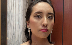 「もうどうにでもなれ」腰痛と思ったら希少がんだった。難病の女性が腫瘍を隠さず「覚悟の写真」を公開した訳