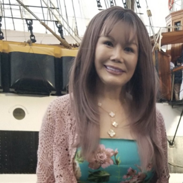 「乳がん」の診断を受けて…「早くわかってよかった」