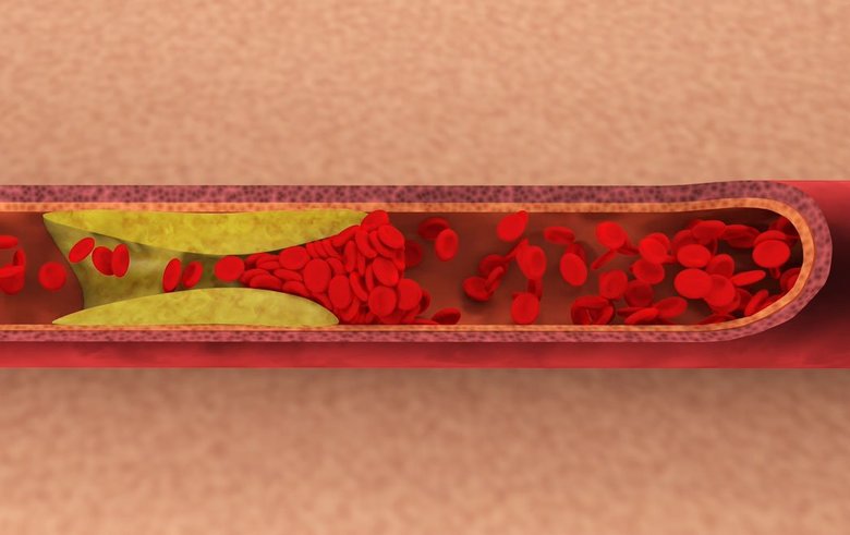 血液が流れる血管のイメージ画像