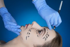 〝身近な整形疑惑〟はママ友たちの大好物「ここが変わった」で盛り上がる！