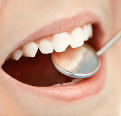 子供の歯列矯正に80万円払う!?夫婦に横たわる価値観のズレ