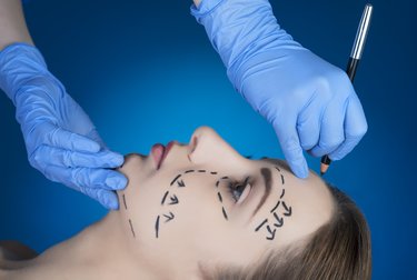 〝身近な整形疑惑〟はママ友たちの大好物「ここが変わった」で盛り上がる！