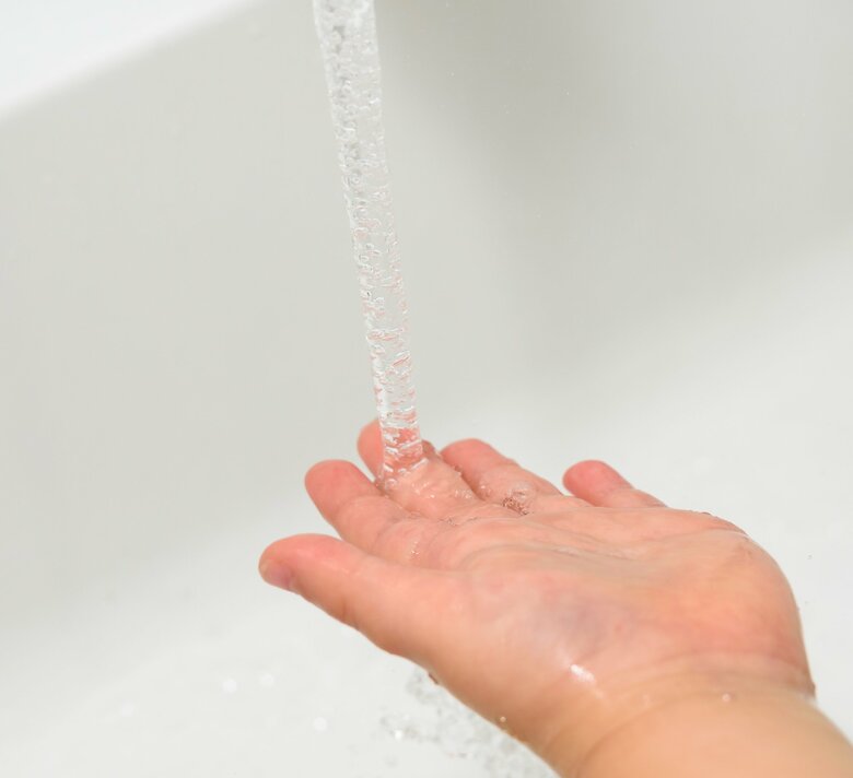 やけどをした箇所を流水で冷やすことが最優先（画像：Pixta）