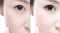 スキマ時間でシワ対策！効果抜群の簡単顔エクササイズ