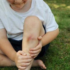 子どものすりむき傷「消毒せずに水洗い」最新手当で〝傷跡残さず〟早く治す