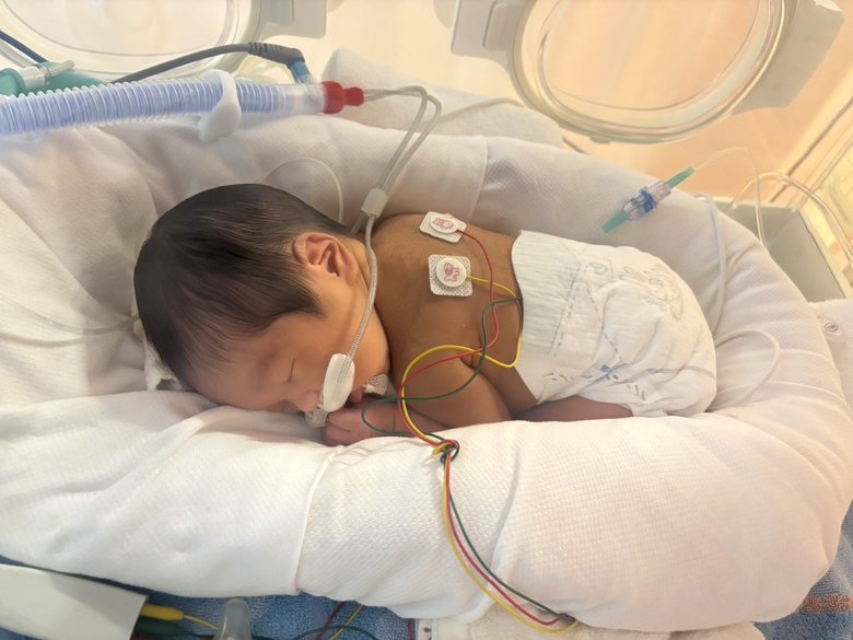 早産で生まれ、NICUに入院したわが子