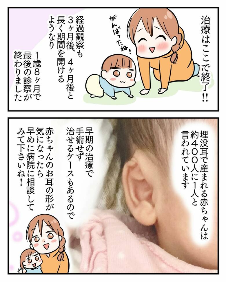 漫画「埋没耳治療しました」9