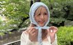 「替え歌で毎日からかわれた」先天性乏毛症に悩んだ女性「攻撃されないために、それでも強い自分を演じ続けた」過去