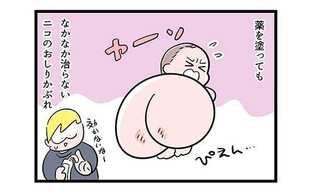 長女のお尻のかぶれ「なかなか治らない!!」【漫画】