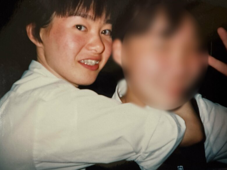 高校時代はニキビを気にしていたそう