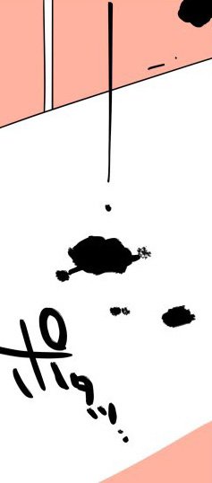 「脱毛しようとして股間が裂けた話」（14/40枚）